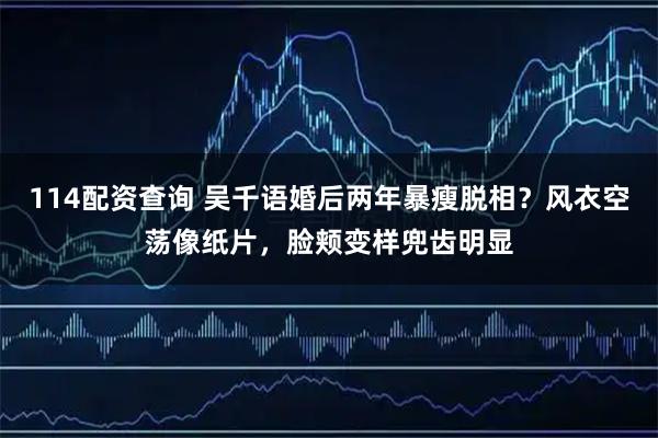 114配资查询 吴千语婚后两年暴瘦脱相？风衣空荡像纸片，脸颊变样兜齿明显